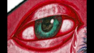 Remedios Caseros para ojos rojos por soldadura remedio casero para después de soldar