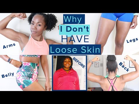 Why I Don't Have LOOSE SKIN After 100 Pound Weight Loss WITHOUT Surgery | TMI Skincare & Nutrition