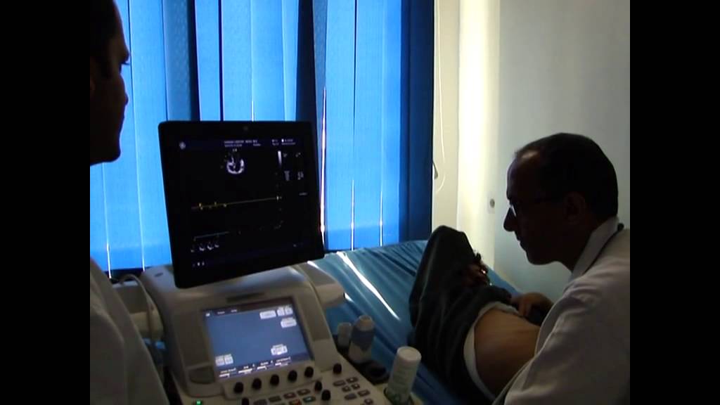DCMP complicated by LV thrombus