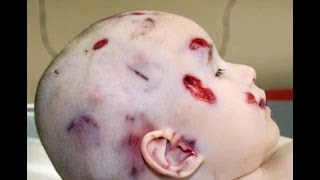 Autopsy    A Mothers Instinct -  New York state Medical Examiner