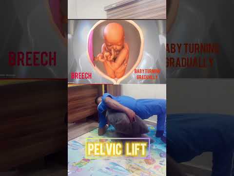 How to turn baby’s head down during pregnancy. #pregnant #fyp