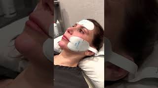 EMFACE  Non-surgical Facial Lifting