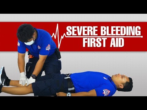 What to do to Help a Person Suffering with Severe Bleeding #Lifesaver