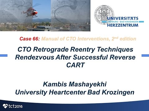 Case 66: Manual of CTO Interventions - Retrograde "rendez vous"