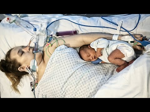 ジェシカの物語-出産と集中治療室の旅 (Jessica's Story - A Journey through Childbirth and Intensive Care Unit)