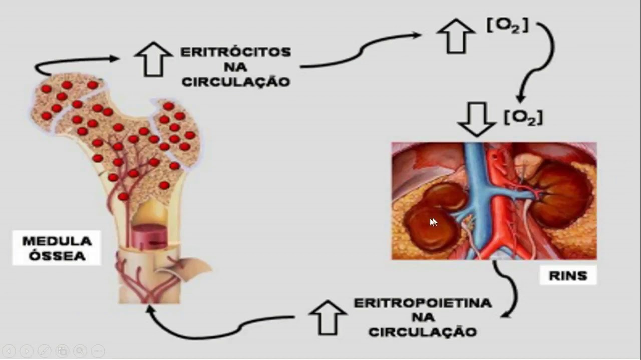 Diagnóstico laboratorial da Anemia Ferropriva - Entendendo a doença e como preveni_la