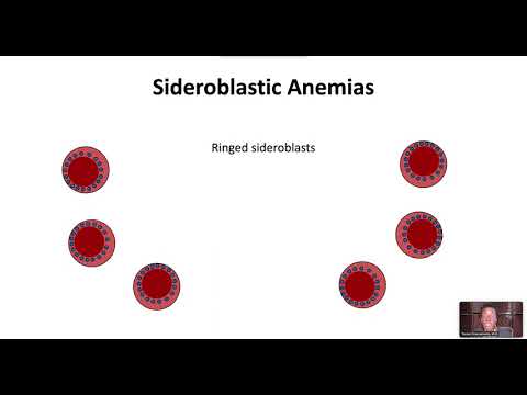 Sideroblastic Anemias