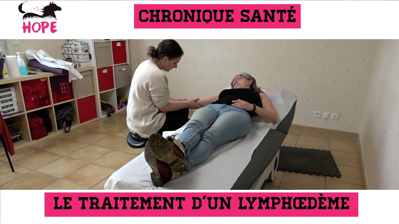 Watch Manchon De Compression Bras Oedeme Now Le traitement d'un lymphœdème