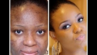 How To Cover Dry/Flaky Skin (Quick Makeup Tip)