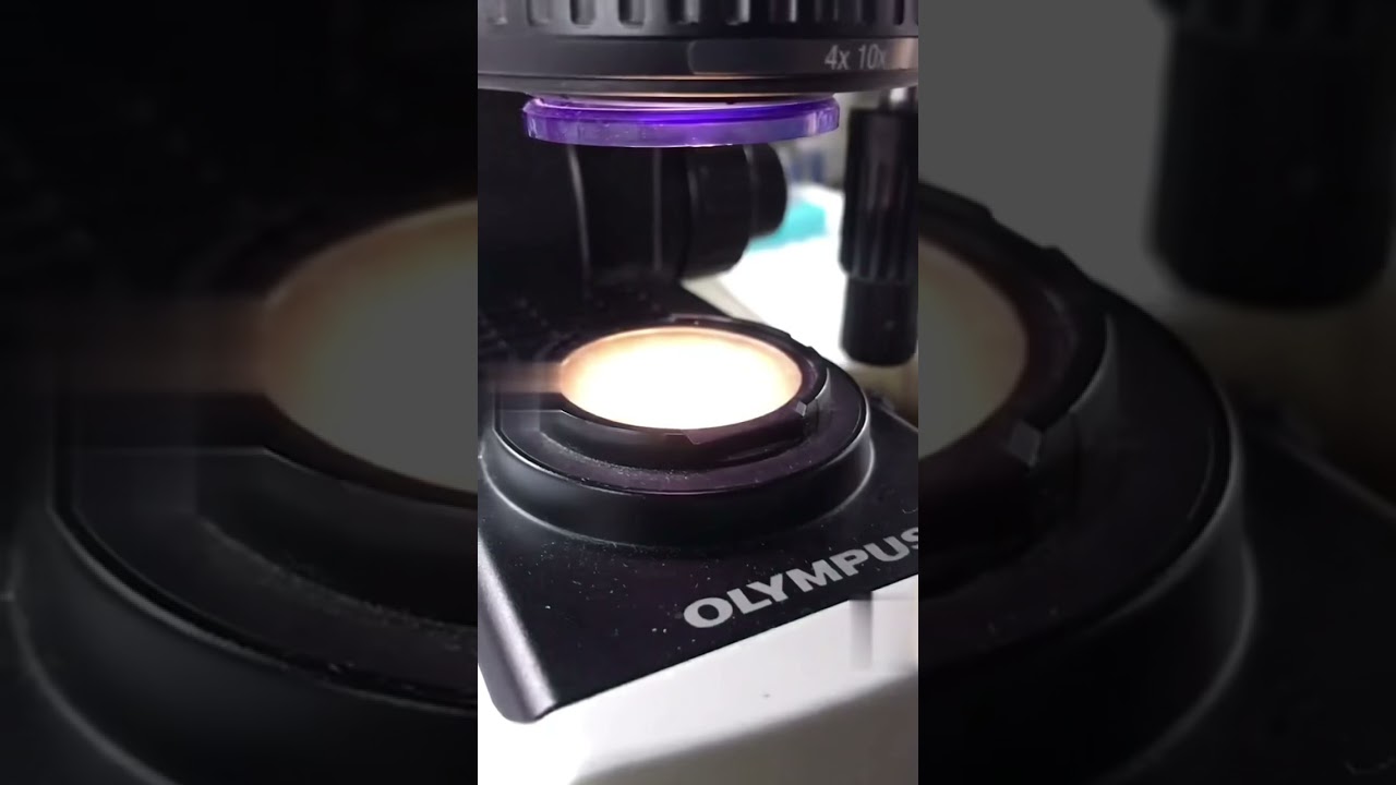 Vigina discharge under the microscope 🔬 🦠🧫