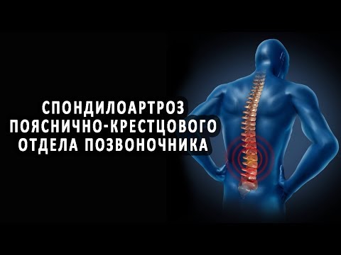 Если при фарингите болит шея Болит спина позывы к мочеиспусканию