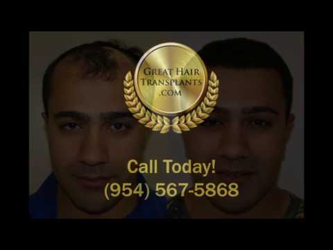 
Dr. Brett Bolton Patient Amir MaxHarvest&trade; Plus Hair Transplant
