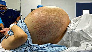 Mamá piensa que tiene Mellizos, Luego el Médico Descubre algo increíble 😩