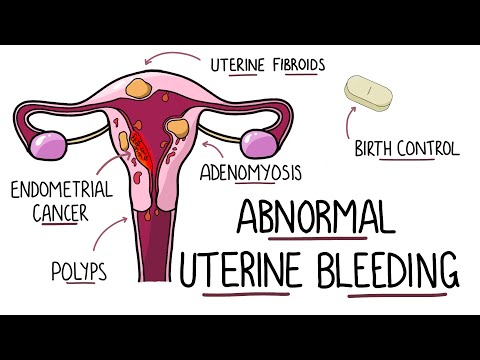 Abnormal Uterine Bleeding (AUB) - Menorrhagia & Heavy Menstrual Bleeding | (Including Mnemonic!)