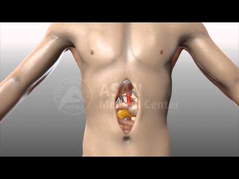 Open abdominal surgery