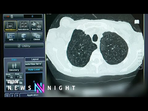 為什麼英格蘭的癌症危機越來越嚴重？- BBC新聞之夜 (Why is England’s cancer crisis getting worse? - BBC Newsnight)