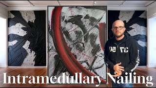 Intramedullary Nailing