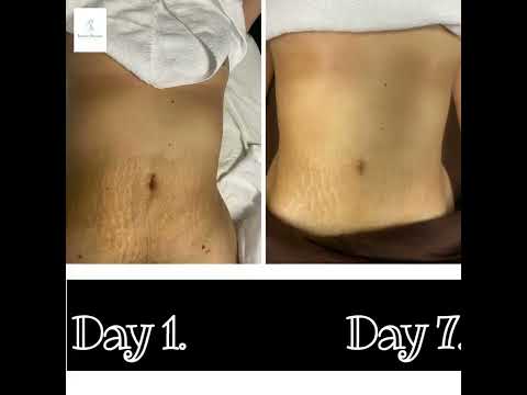 Make sure you have a wonderful Spa day @Tatiana’s Massage Therapy 💆🏻‍♀️💆🏻‍♂️🙏🏼