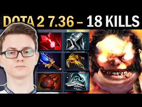 Pudge Gameplay Miracle with 18 Kills and Heart - Dota 2 Ringmaster