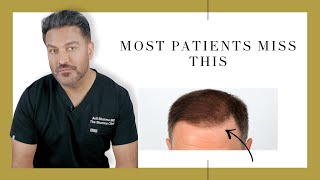 Canadian Hair Transplant Centre