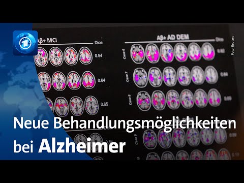 Alzheimer-Medikament vor Zulassung in der EU