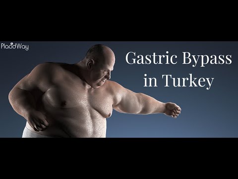 Gastric Bypass in Turkey