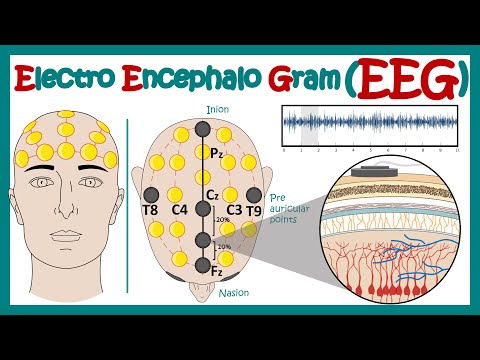 Electroencephalography (EEG) | How EEG test works? | What conditions can an EEG diagnose? | Animated
