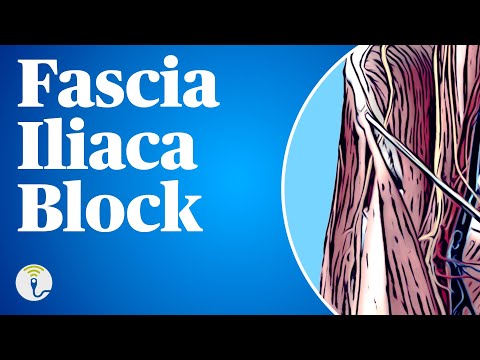 Ultrasound-Guided Fascia Iliaca Plane Block (Suprainguinal) | Anatomy & Technique
