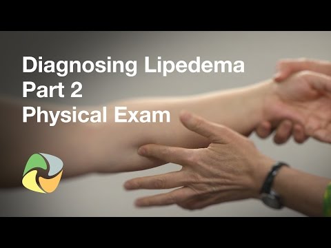 Diagnosing Lipedema Part 2 - Physical Exam
