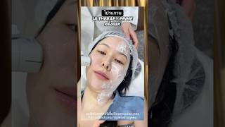 #ultherapy #ultheraprime ครั้งแรกประทับใจลดความรู้สึกไปเยอะมาก #erkerkxcclinic #slcclinic 🩵