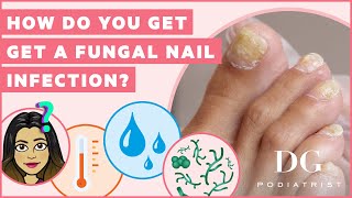 How do you get a fungal nail infection?