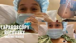 Laparoscopy Vlog + Recovery │Stage 2 Endometriosis