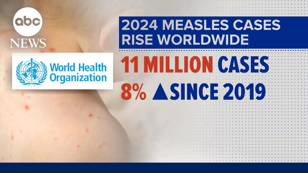 Measles Outbreak: Global Health Emergency Declared! What Happens Next?
