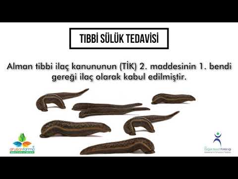 Yumurtalık kistleri