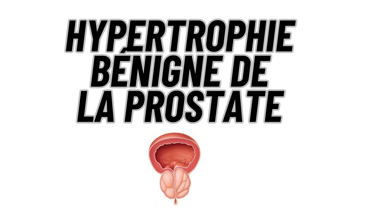Hypertrophie bénigne de la prostate
