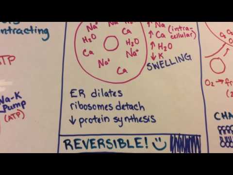 Ischemic Reperfusion Injury