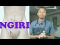 NGIRI HERNIA Sababu Dalili Matibabu