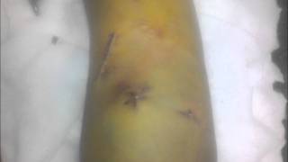 Una historia de Alvite - Ismael Serrano