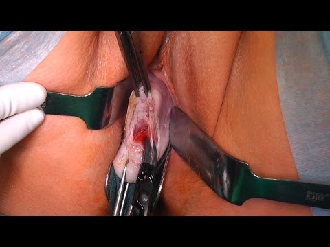 Wie lange dauert die Behandlung der chronischen Prostatitis Medizinprodukt Behandlung von Prostatitis kaufen