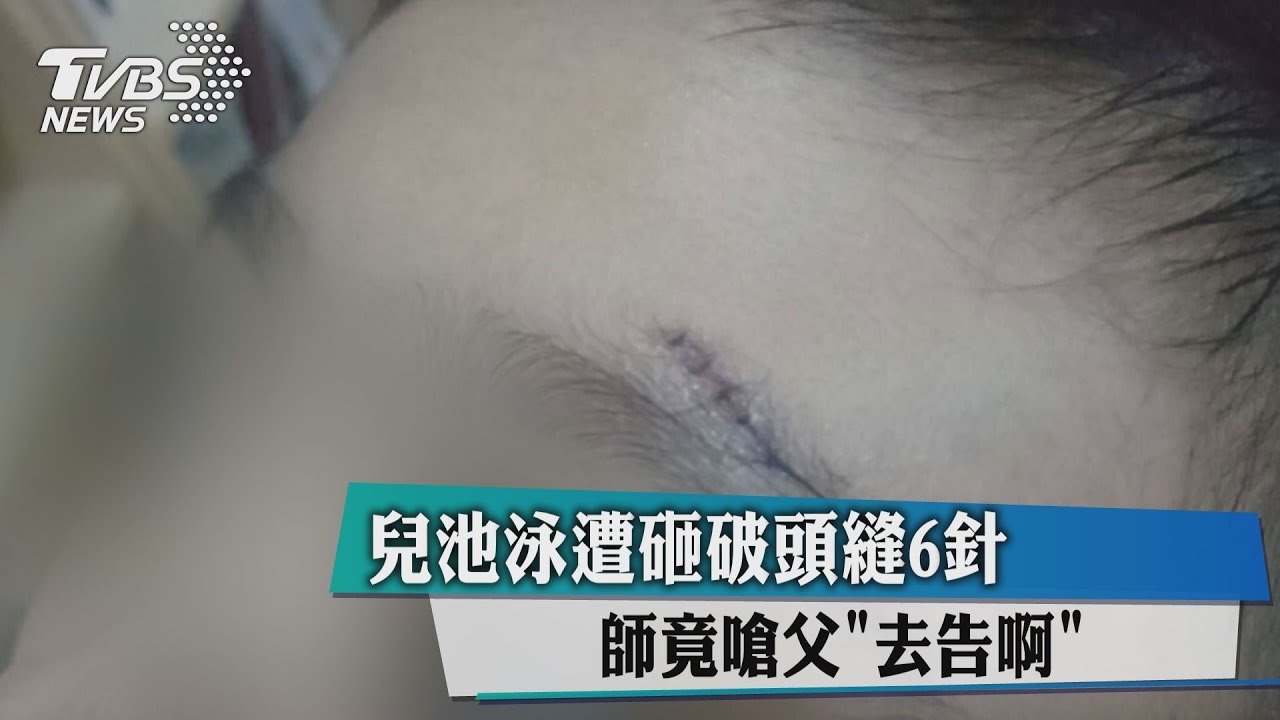 兒泳池遭砸破頭縫6針　師竟嗆父「去告啊」！