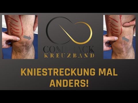 Streckdefizit nach Kreuzband-OP - Kniestreckung verbessern durch Ansteuern des M. vastus medialis