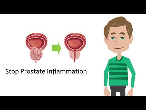 Candele della prostata e le emorroidi Trattamento ALMAG della prostata