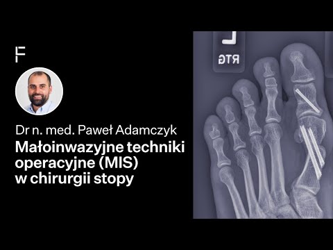 Paweł Adamczyk-6