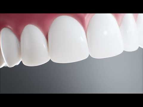 Teeth Whitening — video thumbnail