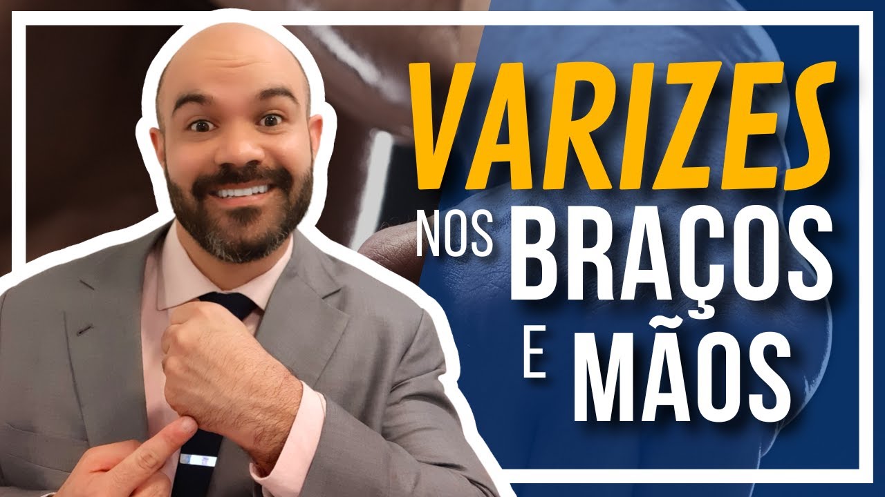 🔴 Varizes das MÃOS e BRAÇOS!! Existe isso? #vidasemvarizes