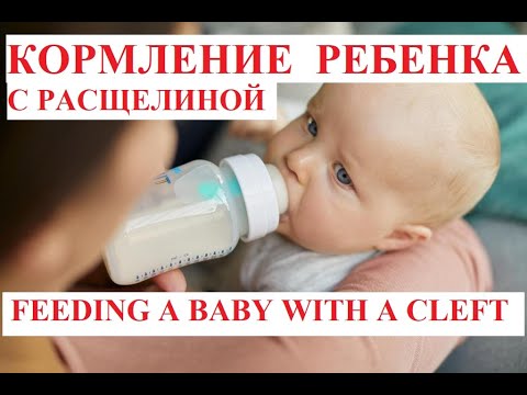 зонд для докорма новорожденных. бутылочка медела для новорожденных с ложкой. соска нук для расщелины. кормление детей с расщелиной губы. плавающий обтуратор для кормления.