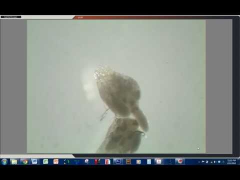 Drosophila Ovary Dissection