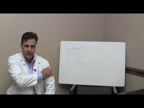 Shoulder Bursitis and Impingement - Shoulder Specialist Houston Sugar Land TX