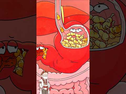 😦 Adevăr șocant despre ruptura de stomac!#shorts #funny #hot