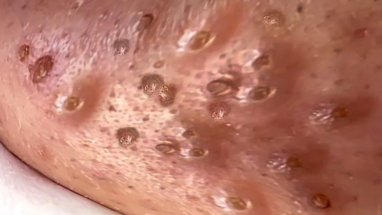 𝑺𝒐𝒐𝒕𝒉𝒊𝒏𝒈 𝑭𝒂𝒄𝒊𝒂𝒍 𝑻𝒓𝒆𝒂𝒕𝒎𝒆𝒏𝒕 𝑭𝒐𝒓 𝑺𝒕𝒓𝒆𝒔𝒔 𝑹𝒆𝒍𝒊𝒆𝒇 𝒂𝒕 𝑳𝒖𝒙𝒖𝒓𝒚 𝑺𝒑𝒂 𝑨𝒄𝒉𝒊𝒆𝒗𝒆 𝑰𝒏𝒏𝒆𝒓 𝑷𝒆𝒂𝒄𝒆 #5001108